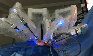 Cirugias robóticas y teledirigidas efectuó equipo pionero fuera de Santiago